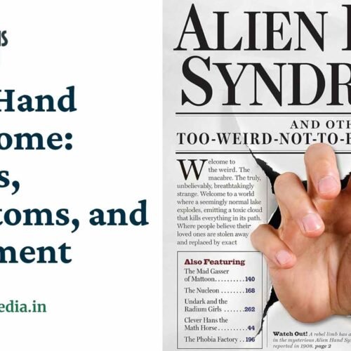 Alien Hand Syndrome