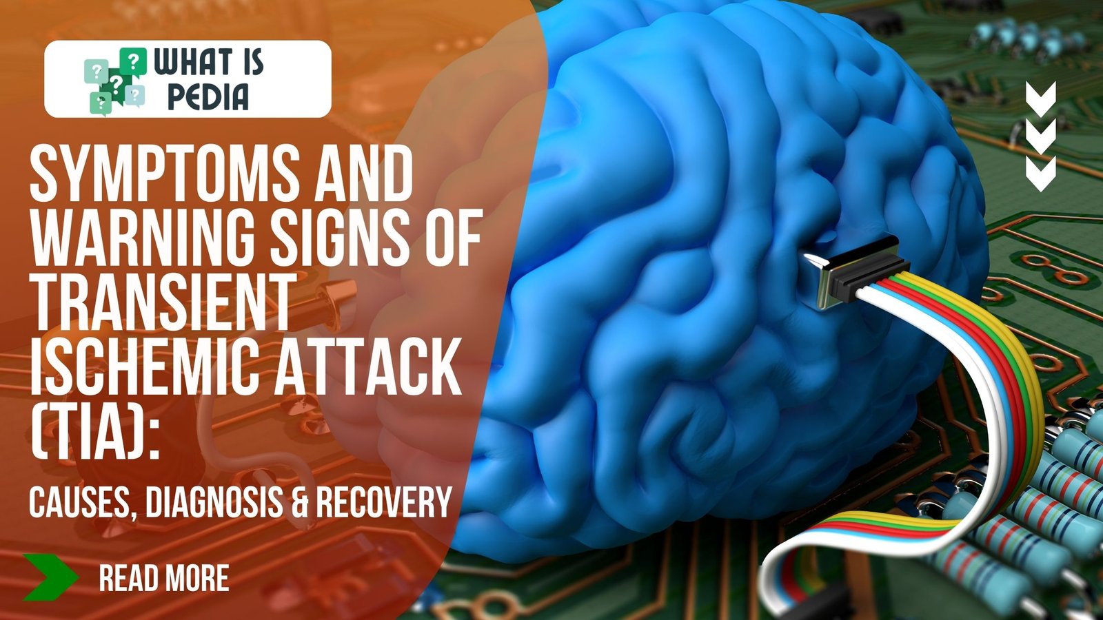 Symptoms and Warning Signs of Transient Ischemic Attack (TIA)
