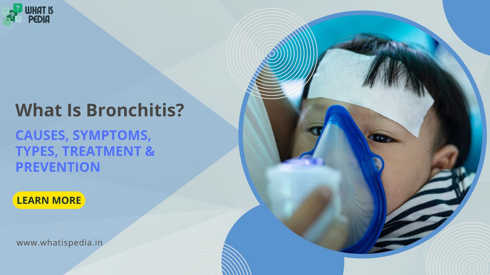 What Is Bronchitis Causes, Symptoms, Types, Treatment & Prevention